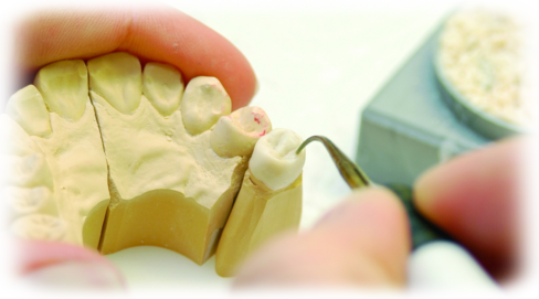 Zahntechniker bearbeitet Zahnkrone 